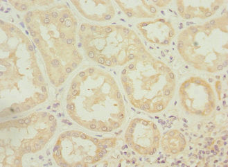 ATP6V0A4 Antibody