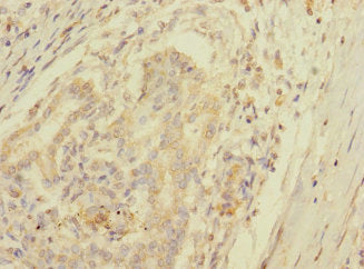 SPC25 Antibody