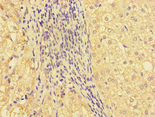 GBA2 Antibody