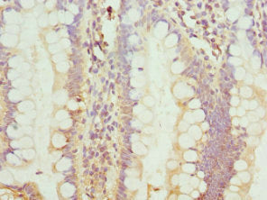 TCIM Antibody