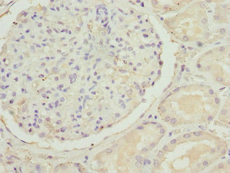 SLC22A11 Antibody