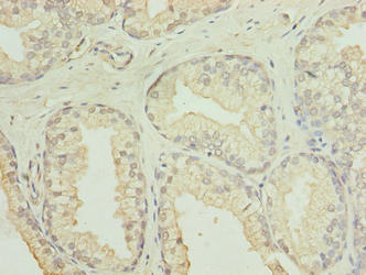 GID8 Antibody