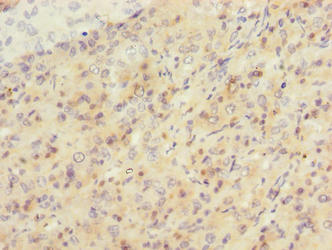SIPA1L2 Antibody