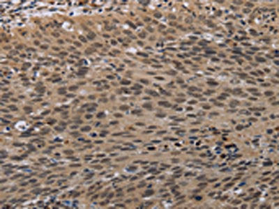 PARP3 Antibody