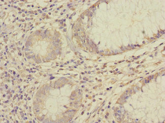 SAE1 Antibody