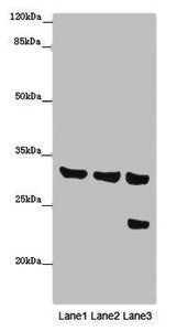 SLC25A10 Antibody