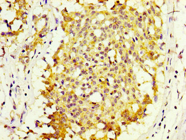 MKRN1 Antibody