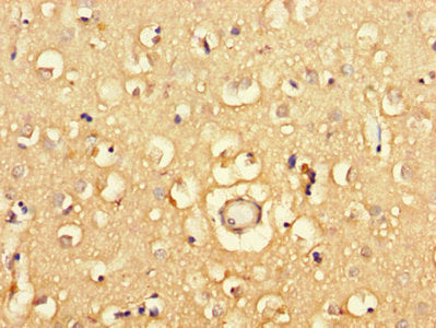 PGAP2 Antibody