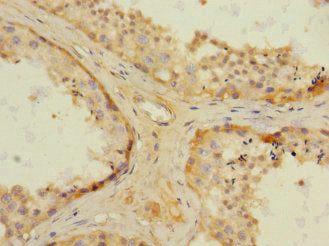 NRBP1 Antibody