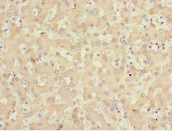 KLF15 Antibody