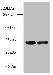 RWDD2A Antibody