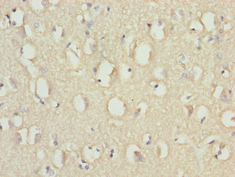 RABGEF1 Antibody