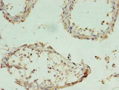 CHAC1 Antibody