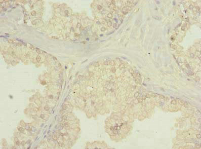 FNDC11 Antibody