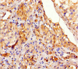 TEX13A Antibody