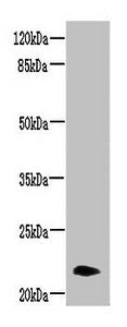 NRSN2 Antibody