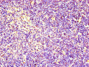 RACGAP1 Antibody