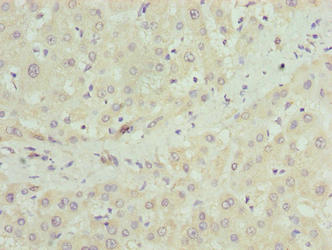 CRISPLD1 Antibody