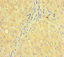 ACTR5 Antibody