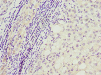 TP53AIP1 Antibody