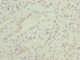 ASNSD1 Antibody