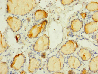 SCN3A Antibody