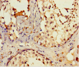 IFT80 Antibody