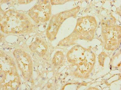 KLHL42 Antibody