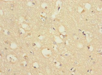 CHRNA9 Antibody