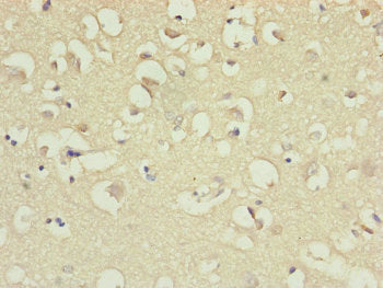 IL36A Antibody