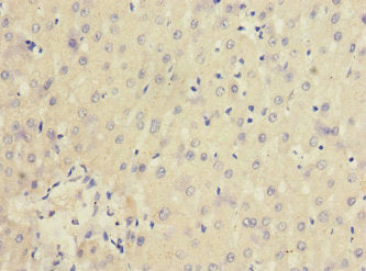 IL20RA Antibody