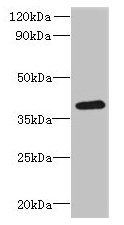 RSPH14 Antibody