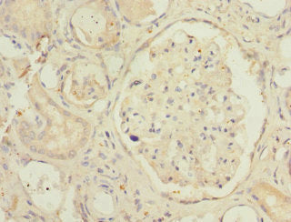 SMPX Antibody