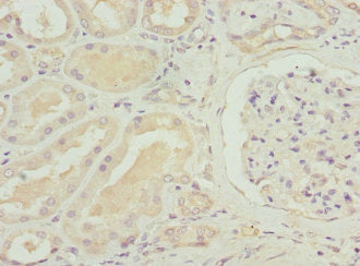 SLC12A6 Antibody