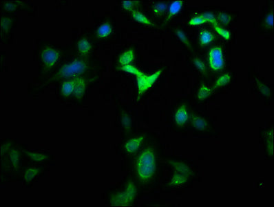 GLS2 Antibody