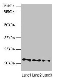 VPS25 Antibody