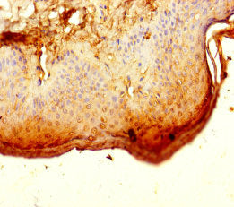 ALG12 Antibody