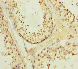 KIFC3 Antibody