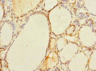 TAPBPL Antibody