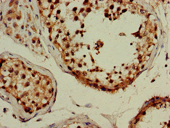 MAP1LC3B Antibody