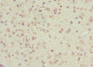 ARL6 Antibody