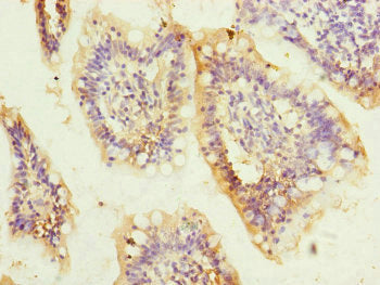 QRSL1 Antibody
