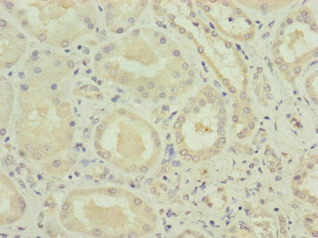 VPS11 Antibody