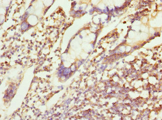 CHMP4B Antibody