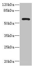 ZCCHC4 Antibody