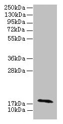 RPP21 Antibody