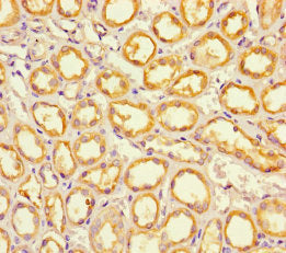 EPS8L2 Antibody