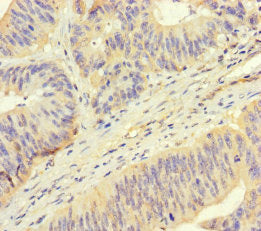 ROPN1 Antibody