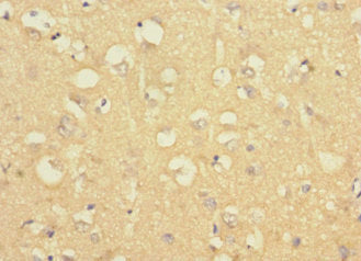 LRRC4C Antibody