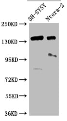 ROBO2 Antibody